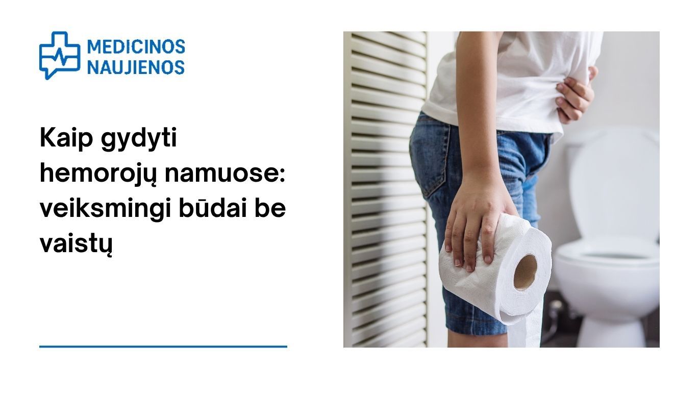 Kaip gydyti hemorojų namuose: veiksmingi būdai be vaistų