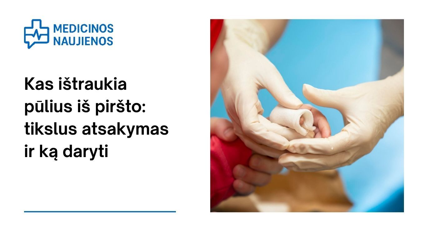 Kas ištraukia pūlius iš piršto: tikslus atsakymas ir ką daryti
