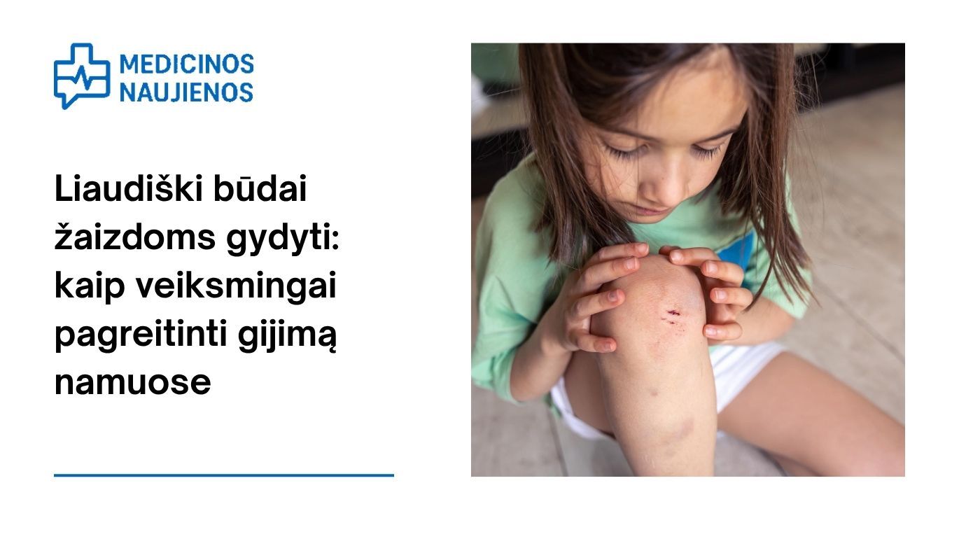 Liaudiški būdai žaizdoms gydyti: kaip veiksmingai pagreitinti gijimą namuose