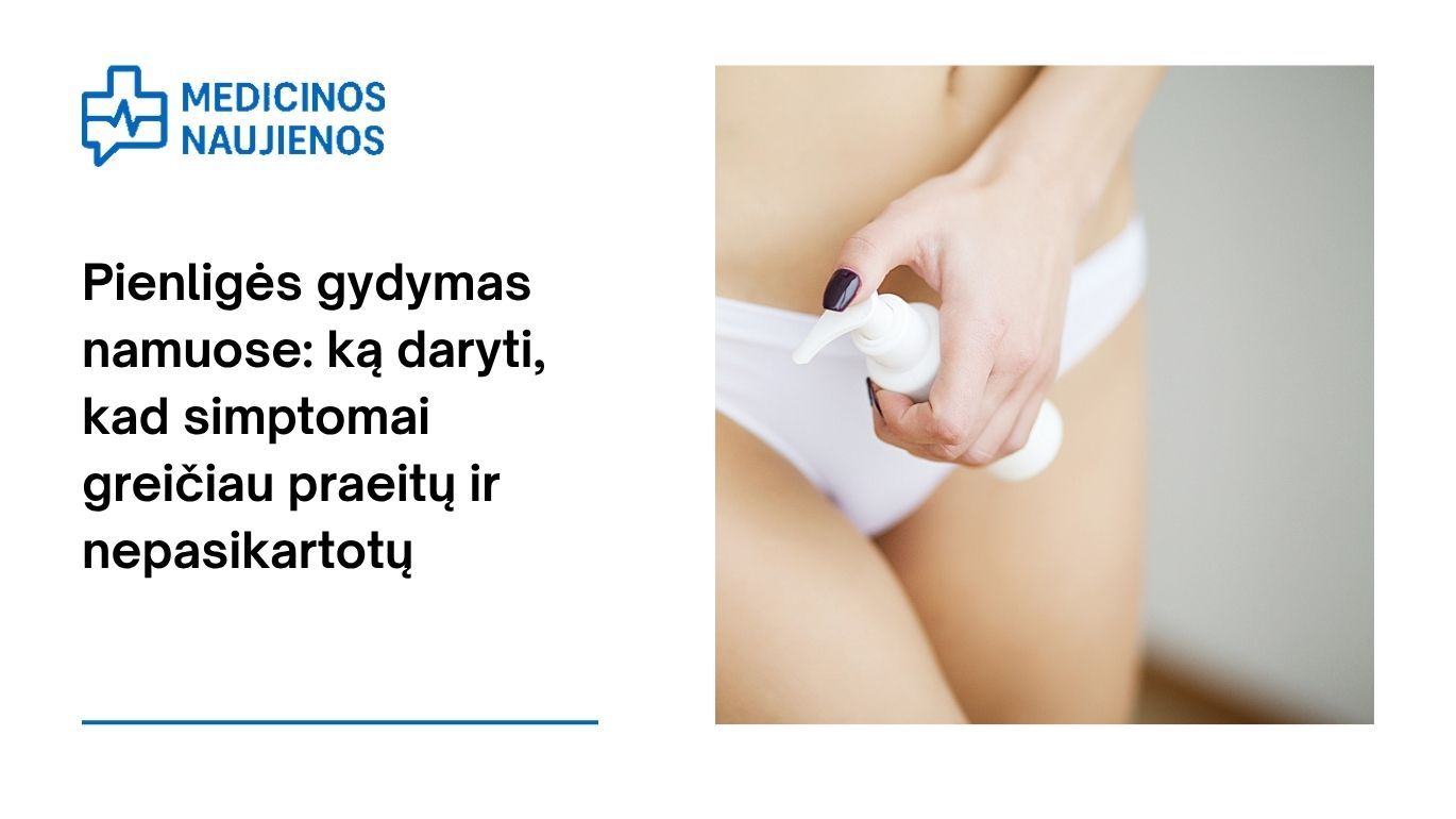 Pienligės gydymas namuose: ką daryti, kad simptomai greičiau praeitų ir nepasikartotų