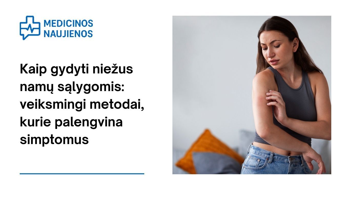 Kaip gydyti niežus namų sąlygomis: veiksmingi metodai, kurie palengvina simptomus