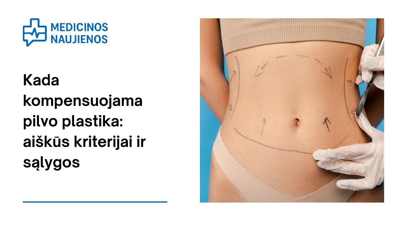 Kada kompensuojama pilvo plastika: aiškūs kriterijai ir sąlygos