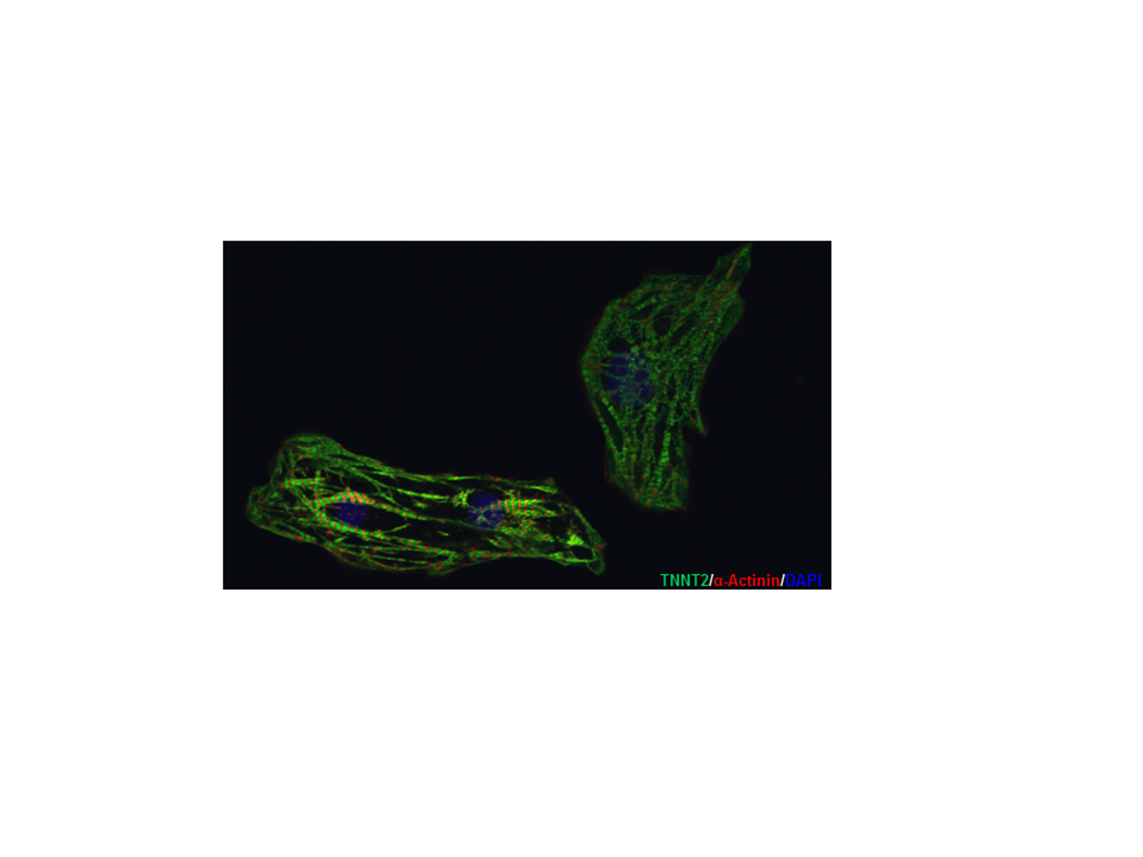 Fluorescence microscopy image of two specimens stained for TNNT2, α-Actinin, and DAPI.