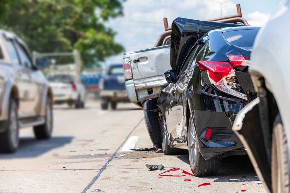 Ask a Philadelphia Car Accident Lawyer: Can A Car Accident Cause Spinal  Stenosis? - Wieand Law Firm