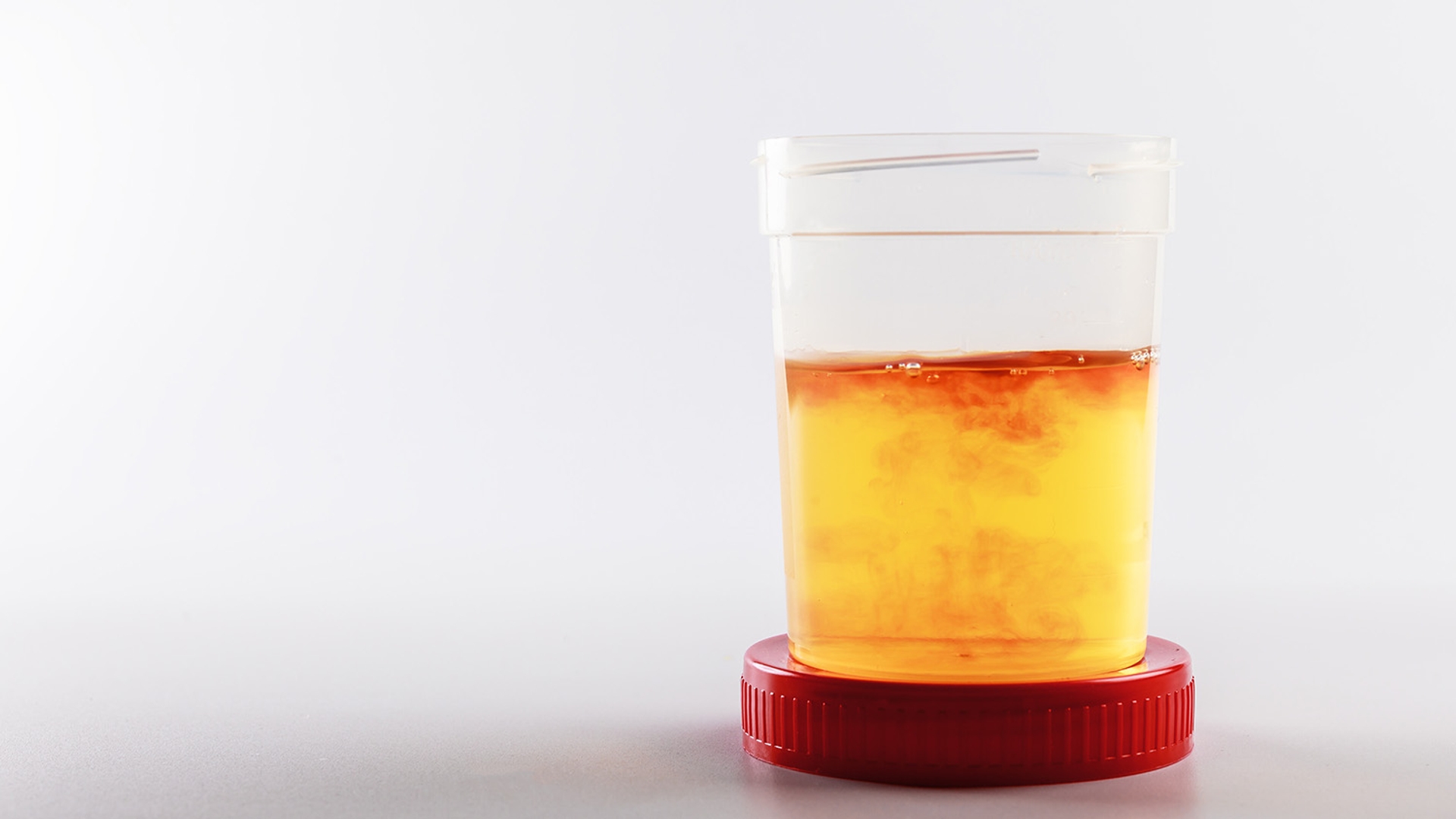 Transparent container with red cap filled with cloudy, orange-yellow liquid on a light grey background