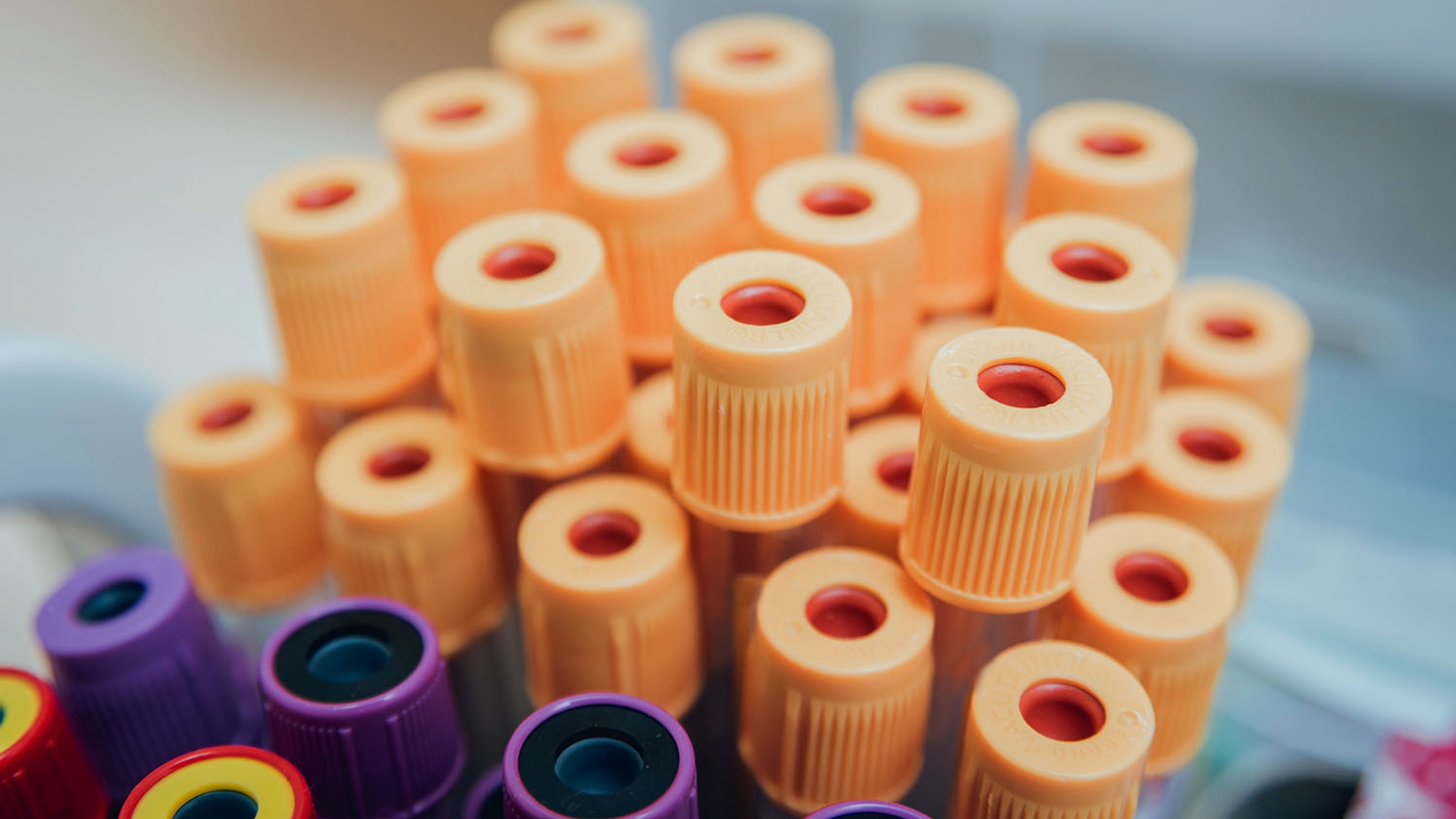 Medical test tubes with orange, purple, and yellow caps.