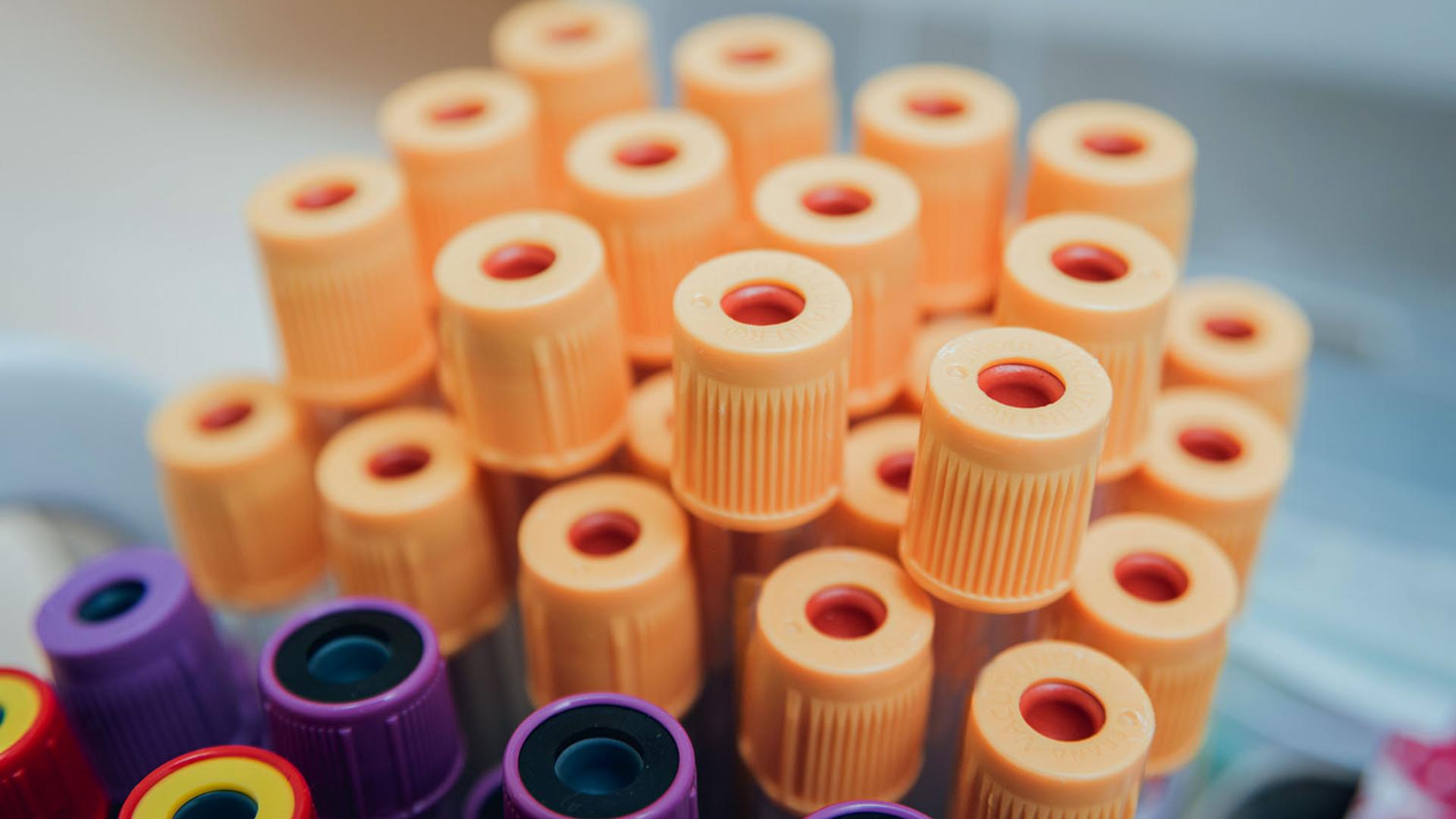 Medical test tubes with orange, purple, and yellow caps.