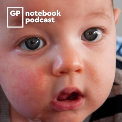 Close-up of a baby's face with big blue eyes and a surprised expression, featuring "GP notebook podcast" logo overlay