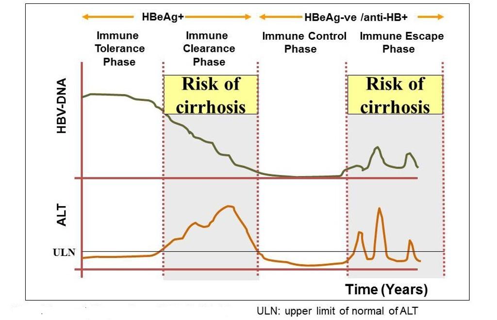 Phases of hepatitis B infection - relating HBe antigen, HBV DNA levels ...