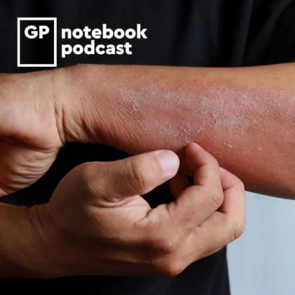 Close-up of a person's arms showing dry, flaky skin condition, with the logo for GP Notebook Podcast in the upper left corner