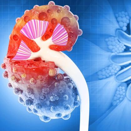 3D illustration of a detailed, color-coded kidney cross-section showing internal structures with cysts, against a blue digital background
