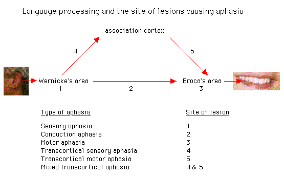 Diagram showing language processing areas in the brain and sites of lesions causing different types of aphasia, with labels for Wernicke's area, Broca's area, and the association cortex.
