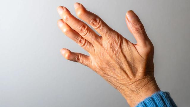 Back of an older person's hand with wrinkles and visible veins, wearing a blue sleeve.