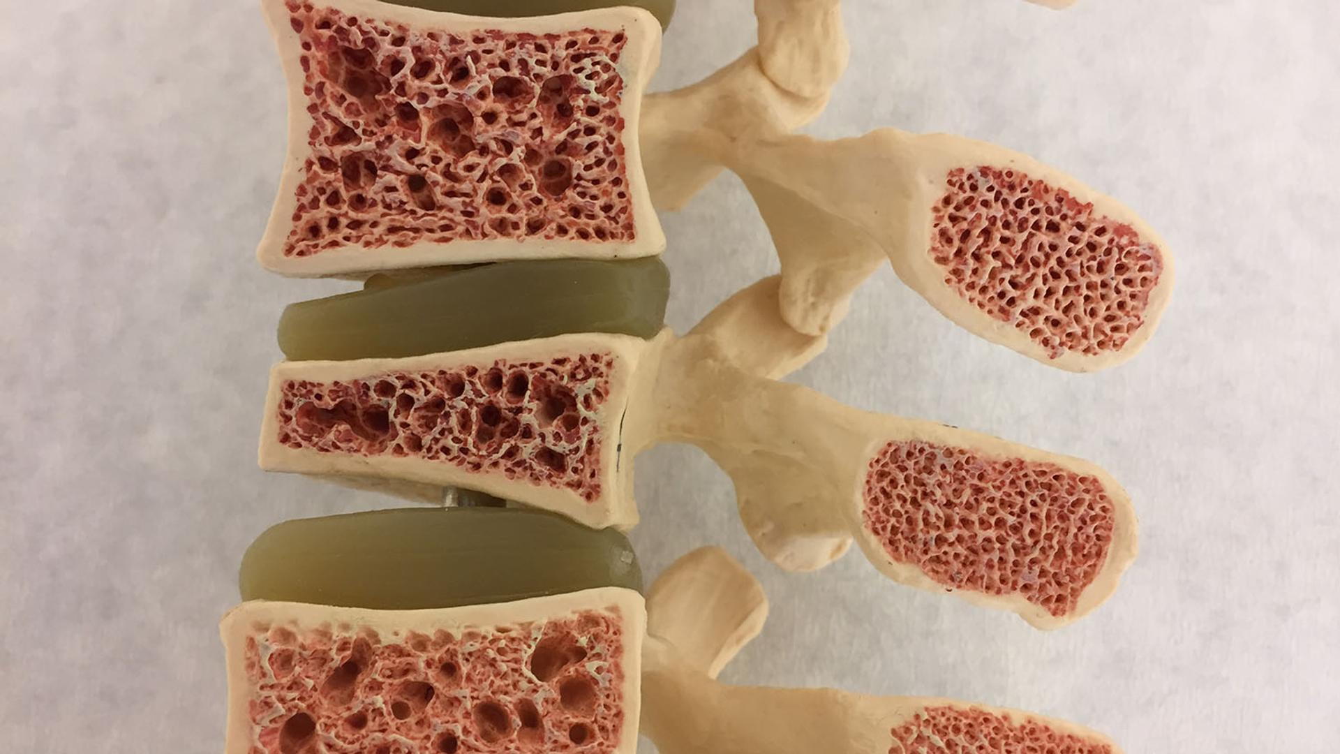 Spine model cross-section revealing porous bone structure in vertebrae and green intervertebral discs.