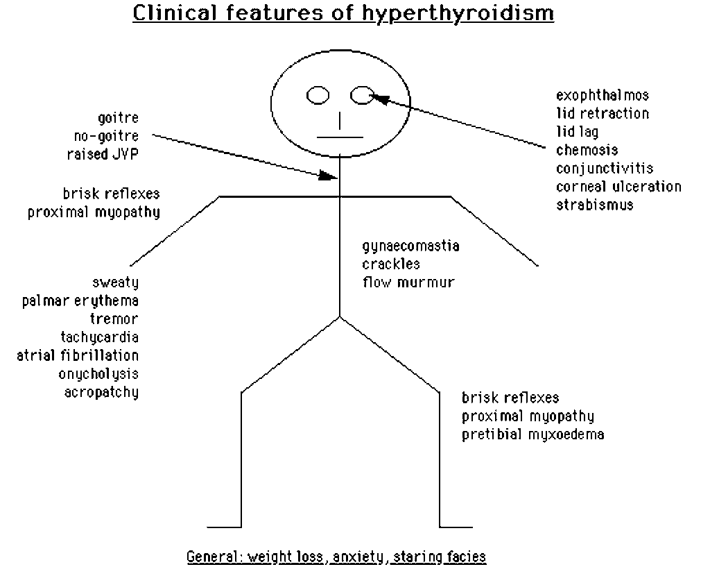 Diagram of the clinical features of hyperthyroidism – GPnotebook ...