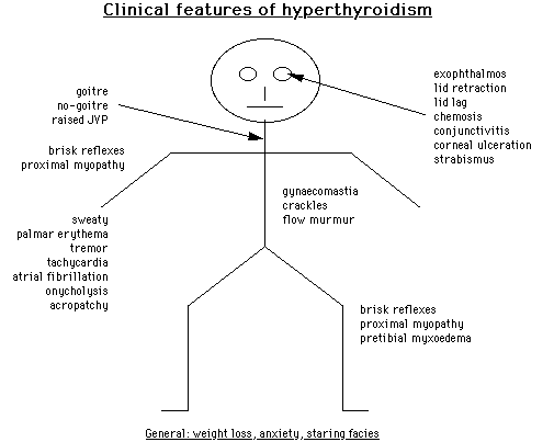 Diagram of the clinical features of hyperthyroidism – Primary Care Notebook