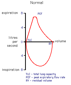 Diagram of a normal spirometry test showing lung volumes and capacities with labels for Total Lung Capacity (TLC), Peak Expiratory Flow Rate (PEF), and Residual Volume (RV).