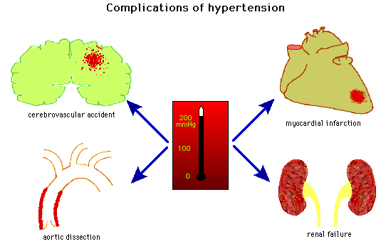 Educational diagram illustrating complications of hypertension, including cerebrovascular accident, myocardial infarction, aortic dissection, and renal failure, with a central blood pressure gauge.