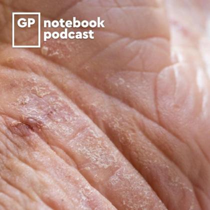 Close-up view of human skin showing dryness and scaling with the logo for GP Notebook podcast in the upper left corner.