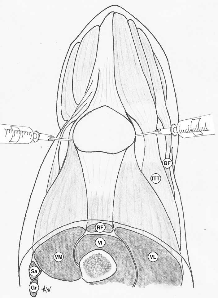 Knee joint injection – GPnotebook