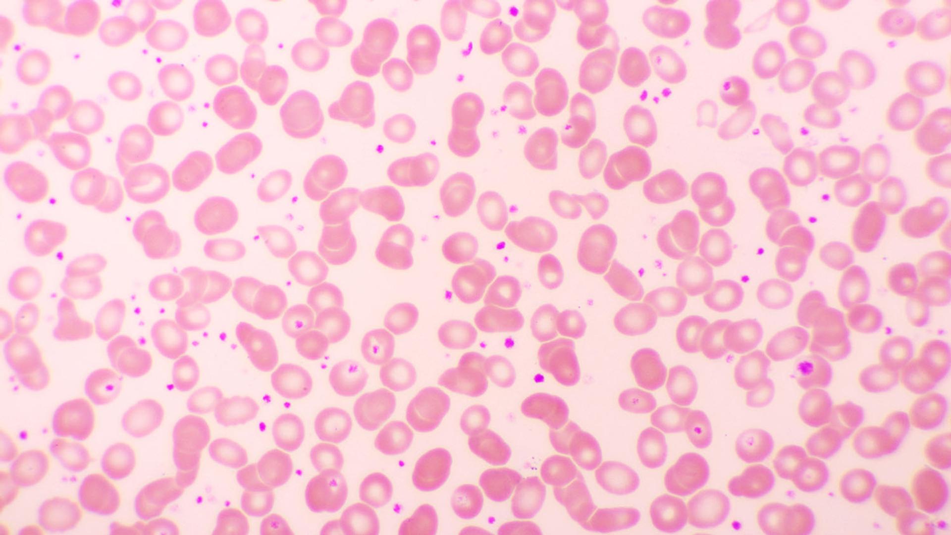 Microscopic view of a blood smear showing numerous pink red blood cells and small purple platelets.
