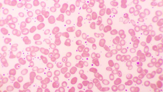 Microscopic view of a blood smear showing numerous pink red blood cells and small purple platelets.