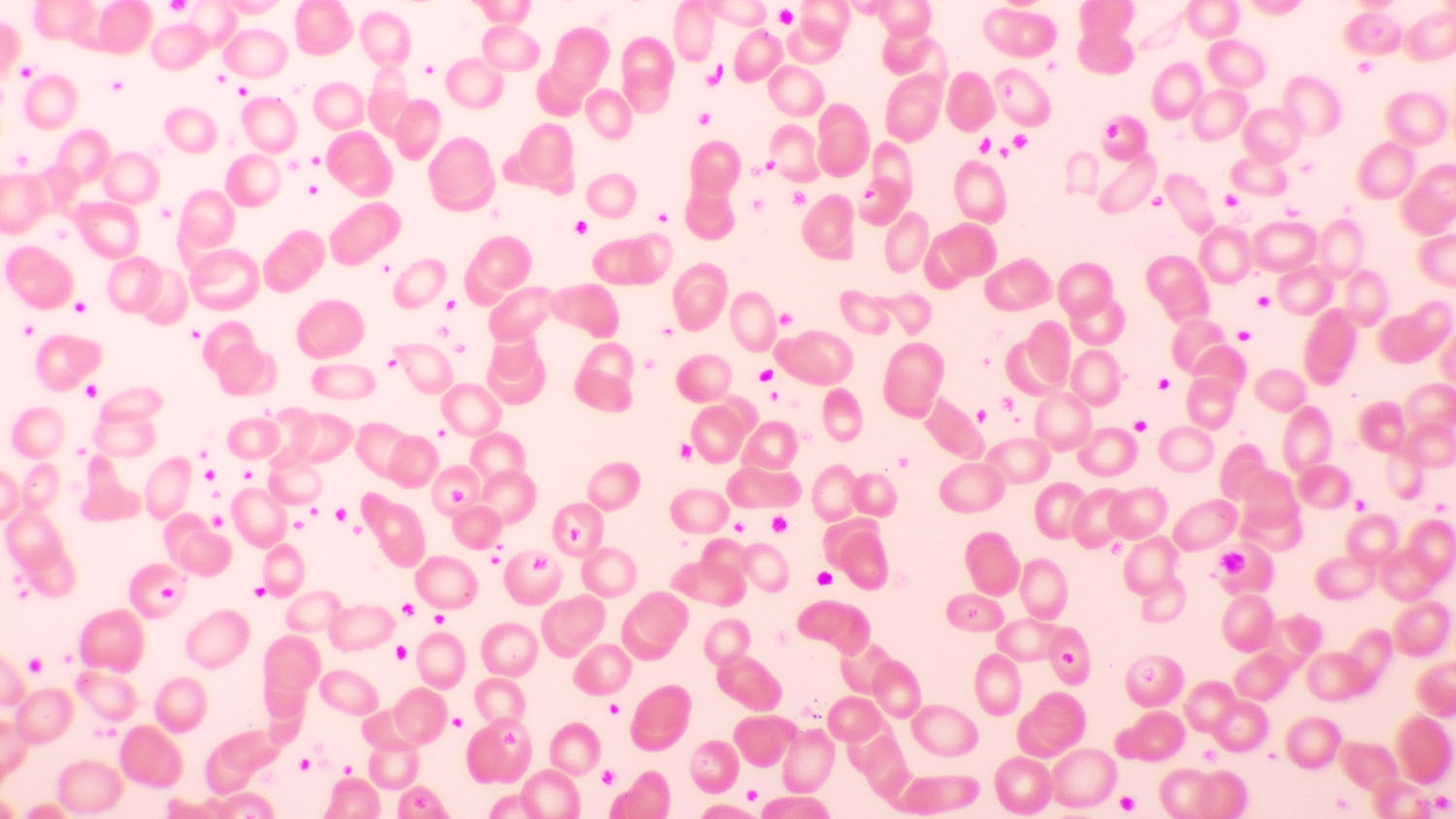 Round Color Platelets Raised platelets – GPnotebook - GPNotebook