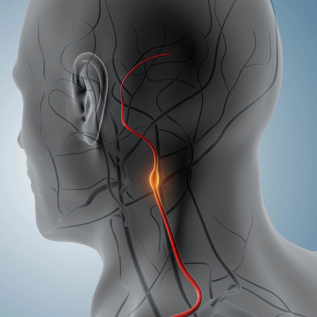 Medical illustration of a translucent human head and neck showing a red nerve with an orange swollen area.