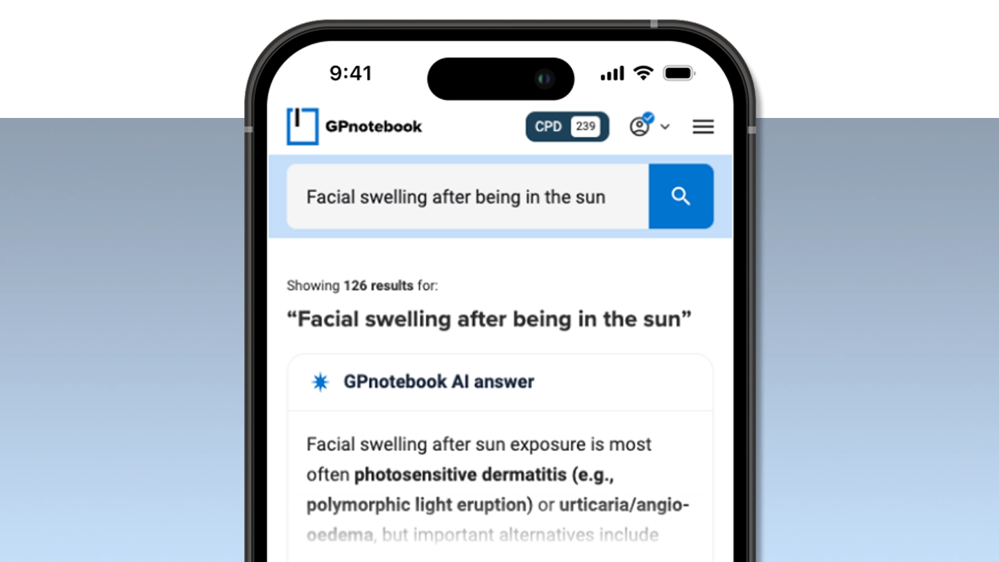 A smartphone displays the GPnotebook app with a search for "Facial swelling after being in the sun" and an AI-generated medical answer.