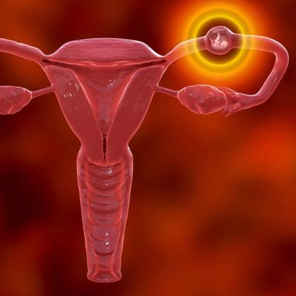 Detailed medical illustration of a human female reproductive system with a highlighted fertilized egg implanting in the uterus on a red background