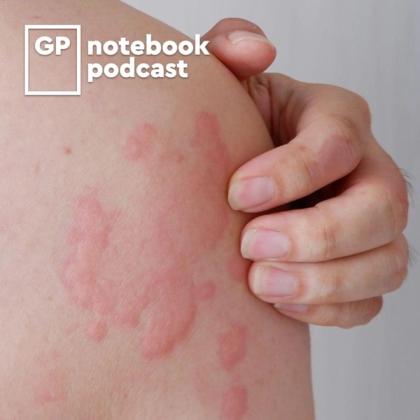 Close-up of a person's arm with visible rash patches, alongside the logo of the GP Notebook podcast