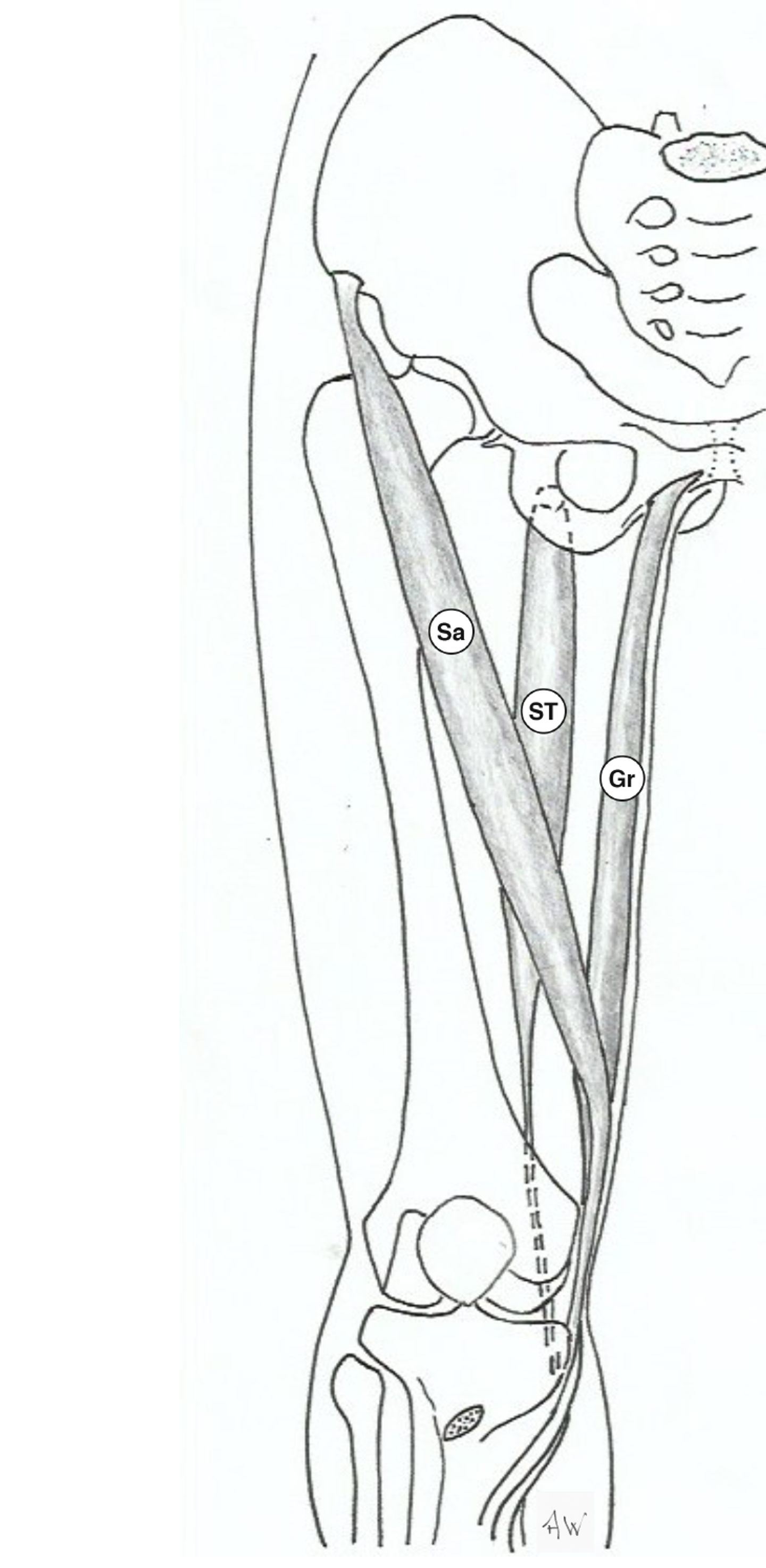 Injection or aspiration of pes anserine bursa – GPnotebook - GPNotebook