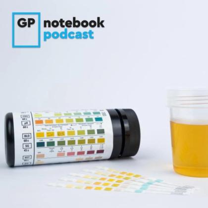 Urine sample beside a urine test strip container and test strips on a white surface, with GP Notebook Podcast logo in the corner.