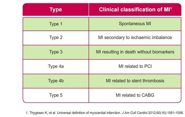 Universal Classification Of Myocardial Infarction (MI) – GPnotebook