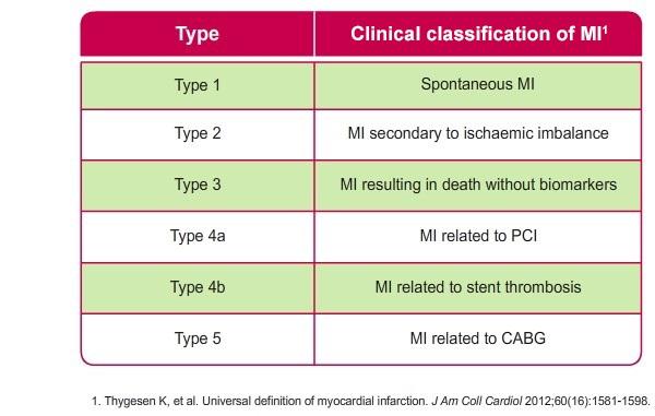 Table showing clinical classification of myocardial infarction types 1 through 5, including terms like spontaneous MI, MI secondary to ischaemic imbalance, and MI related to PCI, stent thrombosis, or CABG.