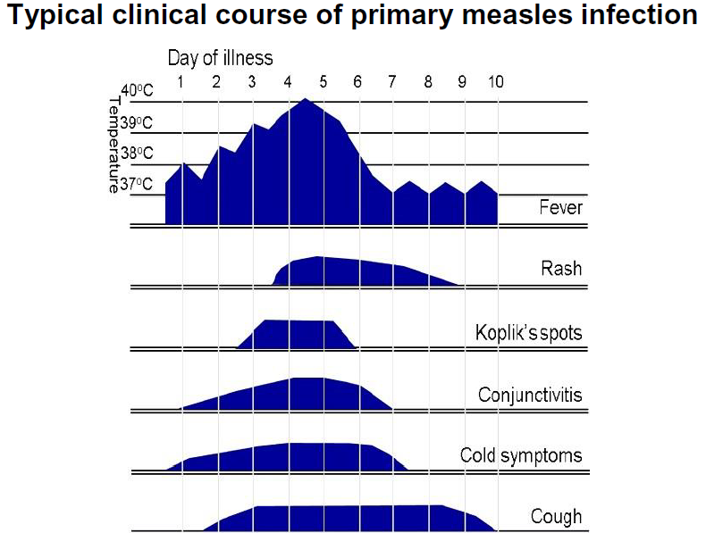 Graph showing the typical clinical course of primary measles infection over 10 days, detailing the progression of symptoms like fever, rash, Koplik's spots, conjunctivitis, cold symptoms, and cough, with temperature in Celsius.