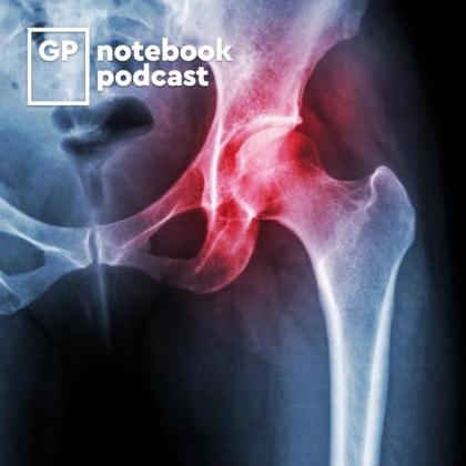 X-ray image of a human hip joint with highlighted areas indicating pain or injury, featuring the logo for GP Notebook podcast