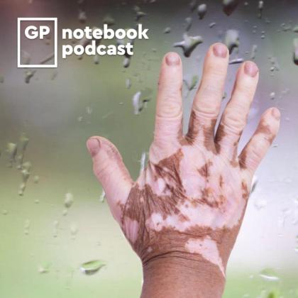 Hand pressed against a rainy window, partially covered in dirt, with the logo for GP notebook podcast in the corner.