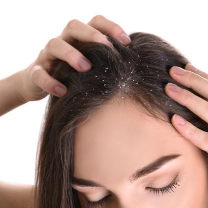 Close-up of a woman examining dandruff in her dark hair