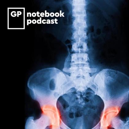 X-ray image showing lumbar spine and pelvic bones with highlighted areas indicating pain, accompanied by the GP Notebook podcast logo on the top left corner.