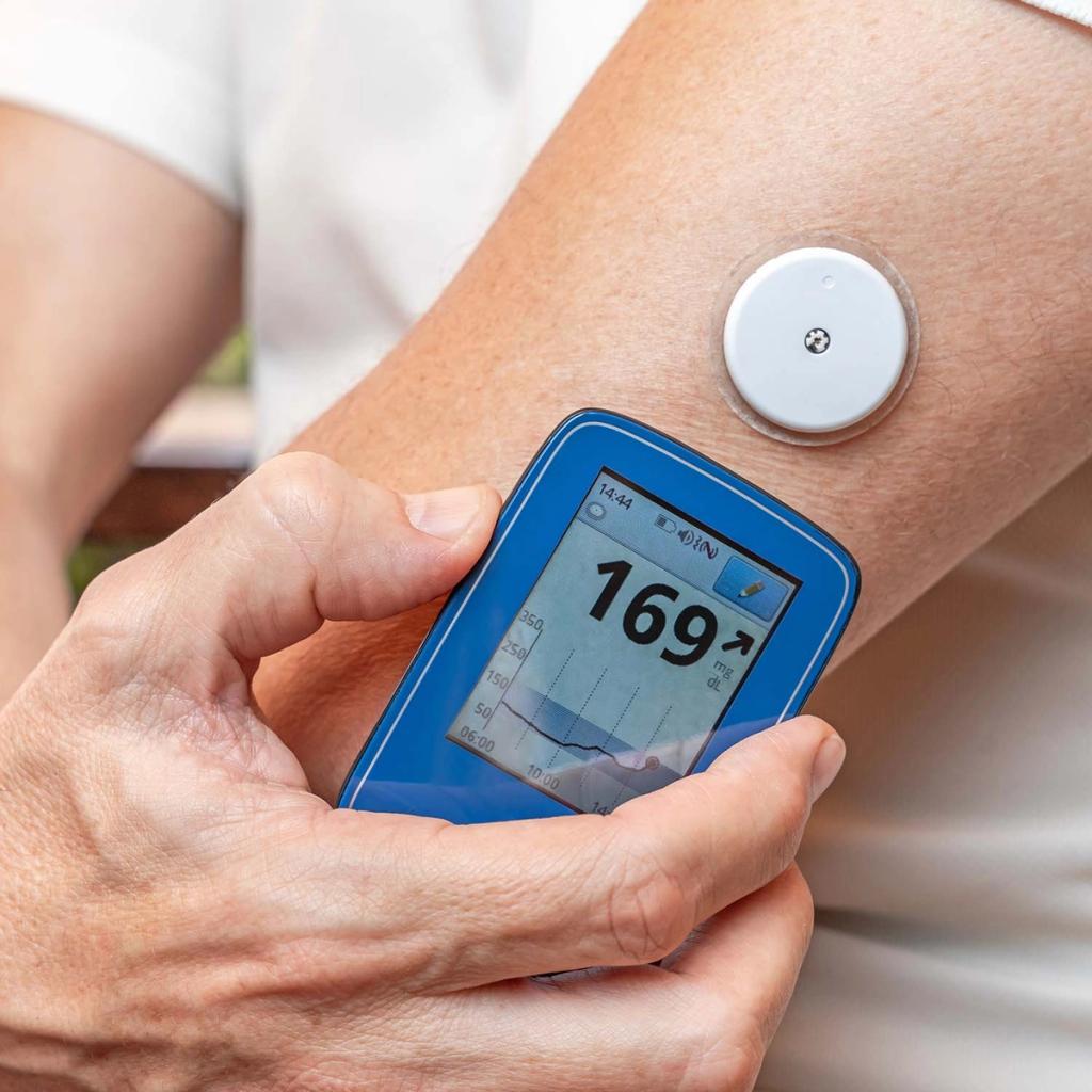 A hand holds a glucose monitor displaying "169 mg/dL" near an arm with a CGM sensor.
