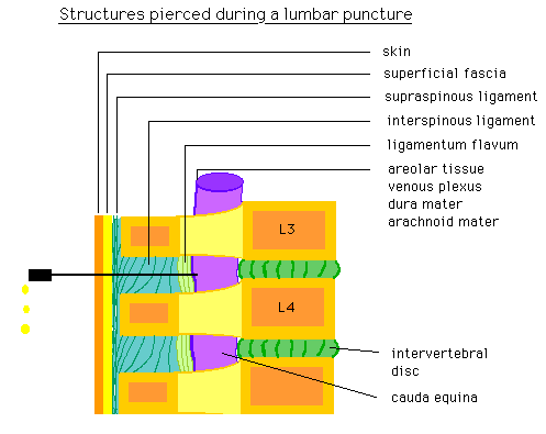 Diagram showing the anatomical structures pierced during a lumbar puncture, labeled with skin, fascia, ligaments, and spinal components at vertebrae L3 and L4.