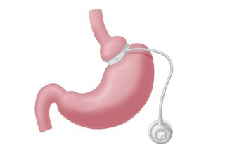 Illustration of a human stomach with a stethoscope wrapped around it, depicting medical examination or health concept