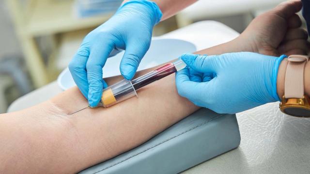 Gloved hands drawing blood from an arm into a test tube.