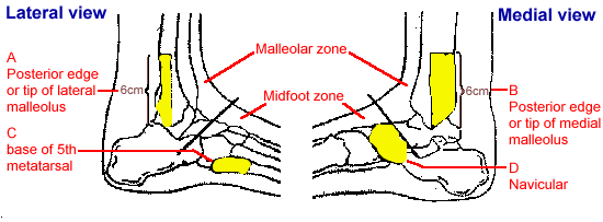 Diagram showing the lateral and medial views of a human foot with highlighted areas indicating the posterior edge of the tibial and medial malleolus, navicular, and base of 5th metatarsal.