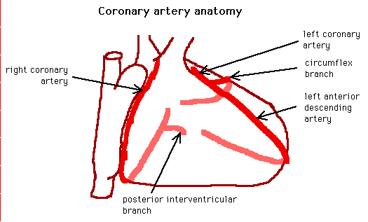 Simplified diagram illustrating the anatomy of the coronary arteries on a human heart, labeled with parts such as the right coronary artery, left coronary artery, circumflex branch, left anterior descending artery, and posterior interventricular branch.