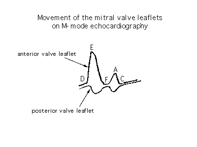 Diagram showing movement of mitral valve leaflets in M-mode echocardiography with labeled peaks for anterior and posterior valve movements.