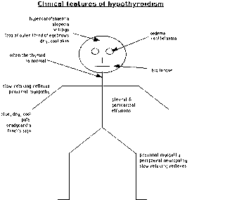 Hypoth Diagram of the clinical features of hypothyroidism – GPnotebook ...