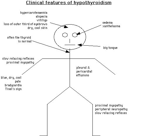 Schematic diagram showing the clinical features of hypothyroidism, including symptoms related to different body parts such as skin, heart, and muscular system.