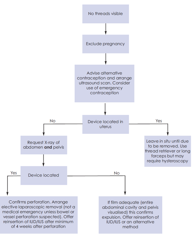 Lost threads (IUCD) – GPnotebook - GPNotebook